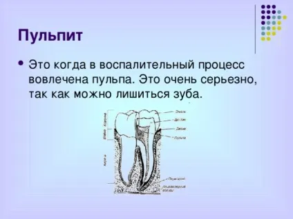 Презентація - профілактика захворювань зубів - біологія, презентації (профілактика) Презентація - профілактика захворювань зубів - біологія, презентації