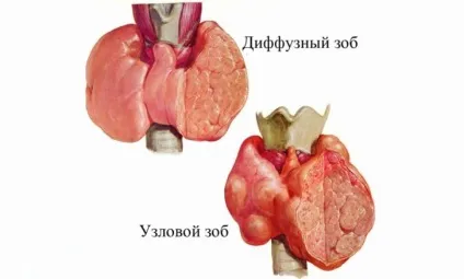Застосування білої перстачу і її кореня при проблемах щитовидної залози - рецепти настоїв і ін засобів (залози) Застосування білої перстачу і її кореня при проблемах щитовидної залози - рецепти настоїв і ін засобів