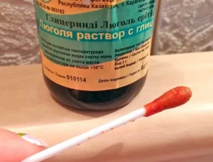 Прищі на мові ближче до горла червоні, білі, білястого відтінку, причини (мовою) Прищі на мові ближче до горла червоні, білі, білястого відтінку, причини