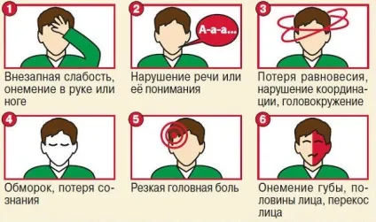 Ознаки мікроінсульту у чоловіків і жінок, перенесеного на ногах, і не тільки (мікроінсульту) Ознаки мікроінсульту у чоловіків і жінок, перенесеного на ногах, і не тільки