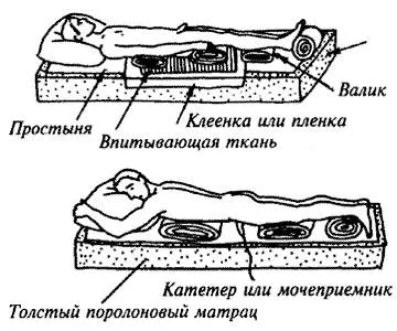 Пролежні - в чому небезпека їх освіти і як цього уникнути (лікування) Пролежні - в чому небезпека їх освіти і як цього уникнути