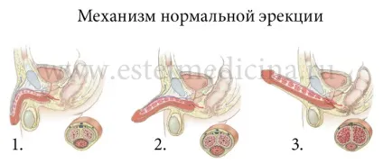 Протезування статевого члена, лікування імпотенції, фаллопротезірованіе ціна, фото, відгуки, (протезування статевого члена) Протезування статевого члена, лікування імпотенції, фаллопротезірованіе ціна, фото, відгуки,