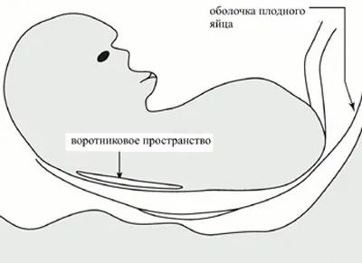 Розшифровка скорочень узі при вагітності - блог моя бетешка (вагітності) Розшифровка скорочень узі при вагітності - блог моя бетешка