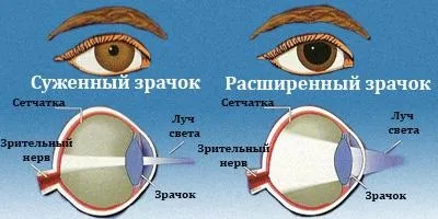 Розширені зіниці у людини причини і як їх звузити (розширені) Розширені зіниці у людини причини і як їх звузити