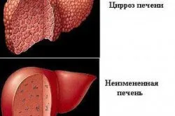 Регулон і алкоголь вплив на печінку і сумісність (сумісність) Регулон і алкоголь вплив на печінку і сумісність