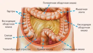 Розрив товстої кишки - фото і причини