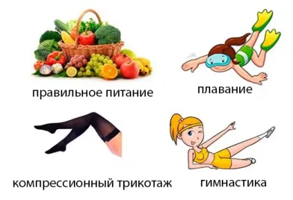 Ретикулярний варикоз що це, причини, лікування (лікування) Ретикулярний варикоз що це, причини, лікування