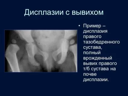 Рентген тазостегнового суглоба для чого проводиться відео (рентген) Рентген тазостегнового суглоба для чого проводиться відео