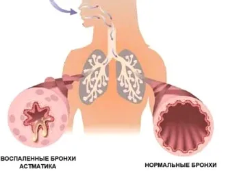Сальбутамол »- інструкція із застосування, ціна, відгуки, аналоги (сальбутамол показання до застосування) Сальбутамол »- інструкція із застосування, ціна, відгуки, аналоги