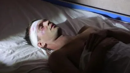 Здавлення головного мозку види, симптоми, діагностика та лікування (здавлення) Здавлення головного мозку види, симптоми, діагностика та лікування