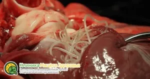 Серцеві глисти у собак симптоми, лікування і профілактика (лікування) Серцеві глисти у собак симптоми, лікування і профілактика