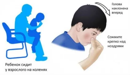 Згустки крові з носа, причини кров'яних згустків (носа) Згустки крові з носа, причини кров'яних згустків