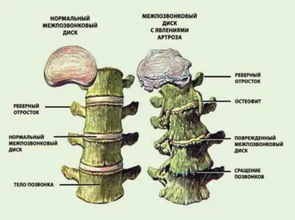 Шийний відділ хребта, будова, функції (відділ) Шийний відділ хребта, будова, функції