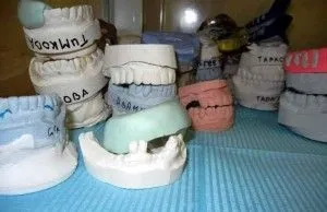 Штамповані коронки етапи виготовлення (штампування) Штамповані коронки етапи виготовлення