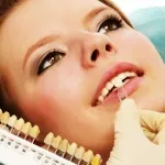 Система домашнього відбілювання hollywood smile (домашнього) Система домашнього відбілювання hollywood smile