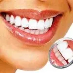 Система домашнього відбілювання hollywood smile (домашнього) Система домашнього відбілювання hollywood smile