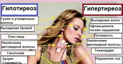 Симптоми щитовидної залози хвороби і причини (захворювання щитовидної залози) Симптоми щитовидної залози хвороби і причини