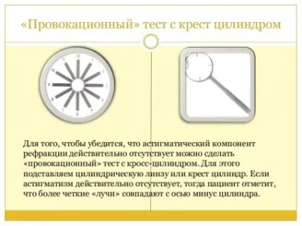 Складний астигматизм як проводитися лікування патології (астигматизму дітей дорослих) Складний астигматизм як проводитися лікування патології