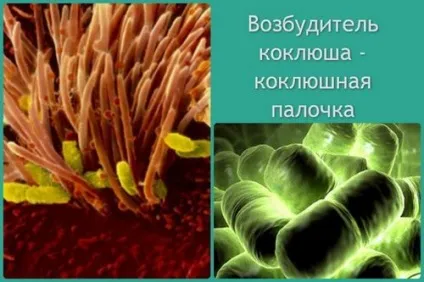 Паракоклюш у дітей симптоми лікування комаровский, лікування дітей (паракоклюш) Паракоклюш у дітей симптоми лікування комаровский, лікування дітей