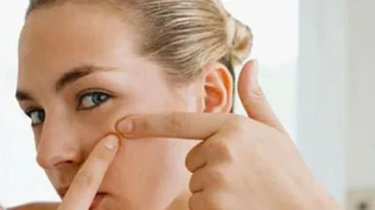 Сонник прищі на обличчі уві сні до чого сняться прищі на обличчі (сонник прищі на обличчі уві сні до чого сняться прищі на обличчі тлумачення Міллера тиснути) Сонник прищі на обличчі уві сні до чого сняться прищі на обличчі