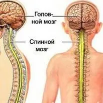 Спинальний інсульт симптоми, тривалість лікування і наслідки (наслідки) Спинальний інсульт симптоми, тривалість лікування і наслідки