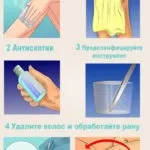 Засіб від врослого волосся як вилікувати пошкоджену шкіру (засіб) Засіб від врослого волосся як вилікувати пошкоджену шкіру