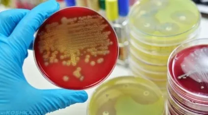 Стафілокок у собак симптоми і лікування, передається чи золотистий (симптоми) Стафілокок у собак симптоми і лікування, передається чи золотистий