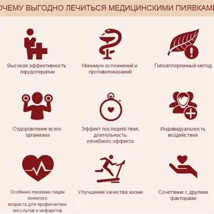 Ставлю п'явки з виїздом на будинок