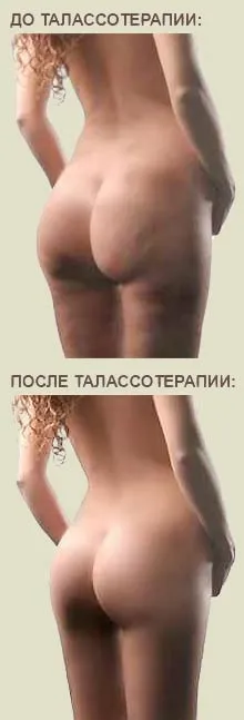 Таласотерапія в Тунісі, талассо-центри та процедури таласотерапії в Тунісі