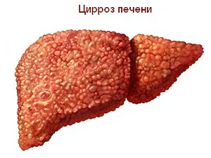 Таблетки для відновлення печінки ніж лікувати печінку (печінки) Таблетки для відновлення печінки ніж лікувати печінку