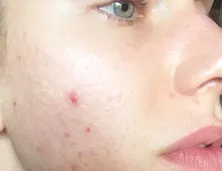 Трави для очищення організму рецепти (рецепти) Трави для очищення організму рецепти
