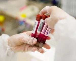Трансплантація кісткового мозку можливі наслідки, де зробити за кордоном (наслідки) Трансплантація кісткового мозку можливі наслідки, де зробити за кордоном