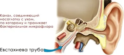Тубоотит у дитини - лікування двостороннього евстахиита у дітей (лікування) Тубоотит у дитини - лікування двостороннього евстахиита у дітей