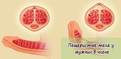 Запалі тіла у чоловіків в члені і що їх збільшує (члені) Запалі тіла у чоловіків в члені і що їх збільшує