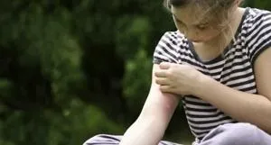 Укус комара як зняти набряк, лікування, допомога дітям - my life (допомога) Укус комара як зняти набряк, лікування, допомога дітям - my life