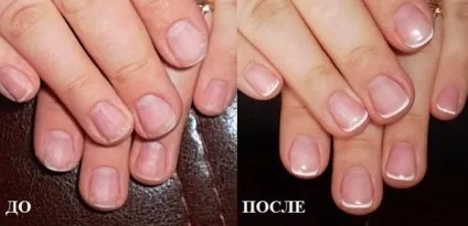 Зміцнення і нарощування нігтів біогелем (нарощування) Зміцнення і нарощування нігтів біогелем