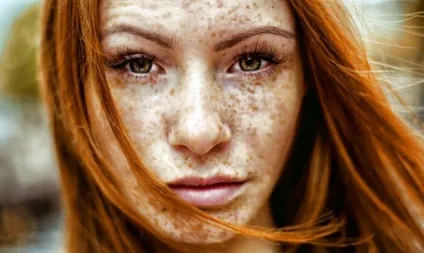 Угри - причини їх появи і маски для усунення (маски) Угри - причини їх появи і маски для усунення