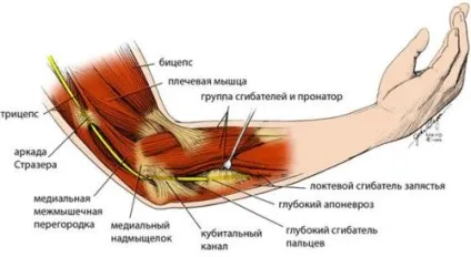 Забій ліктя (при падінні) лікування, зняття пухлини (забій) Забій ліктя (при падінні) лікування, зняття пухлини