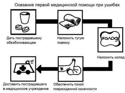 Забій голеностопа симптоми і лікування (голеностопа) Забій голеностопа симптоми і лікування