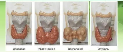 Узі щитовидної залози як підготуватися