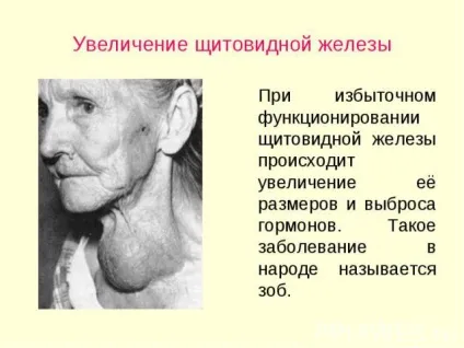 Узі щитовидної залози що показує і розшифровка (щитовидної) Узі щитовидної залози що показує і розшифровка