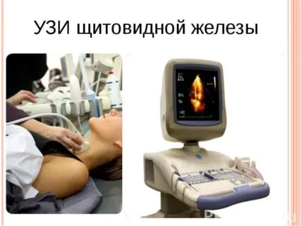Узі щитовидної залози що показує і розшифровка (показує) Узі щитовидної залози що показує і розшифровка