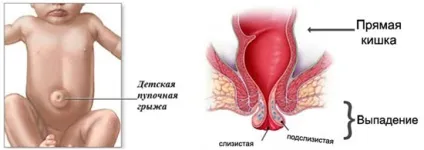 Коклюш ускладнення, прогноз і імунітет (імунітет) Коклюш ускладнення, прогноз і імунітет