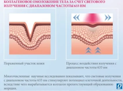 Колагеновий солярій показання і протипоказання (колагеновий солярій) Колагеновий солярій показання і протипоказання