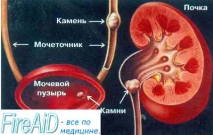 Ниркова колька