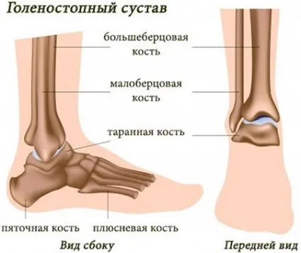 Вивих гомілковостопного суглоба лікування підвивиху голеностопа в домашніх умовах (суглоба) Вивих гомілковостопного суглоба лікування підвивиху голеностопа в домашніх умовах