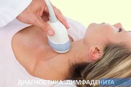 Запалення лімфатичних вузлів як лікують лімфаденіт (запалення лімфатичних вузлів) Запалення лімфатичних вузлів як лікують лімфаденіт