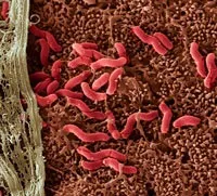 Хелікобактер пілорі (helicobacter pylori) (кишка) Хелікобактер пілорі (helicobacter pylori)