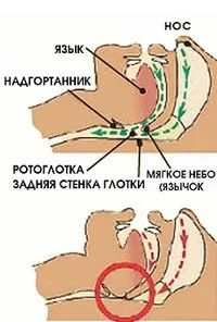 Хропіння у чоловіків - причини і лікування (як позбавиться від хропіння чоловіка) Хропіння у чоловіків - причини і лікування