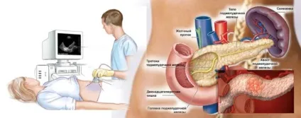 Хронічний панкреатит симптоми, діагностика та особливості лікування (діагностика) Хронічний панкреатит симптоми, діагностика та особливості лікування